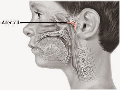 ¿Qué son la glándulas adenoides?