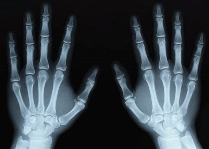 El descubrimiento de los Rayos X